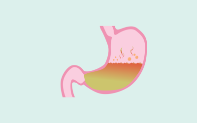 Chronic Acid Reflux and the Decline and Fall of the Modern Stomach: Part 1