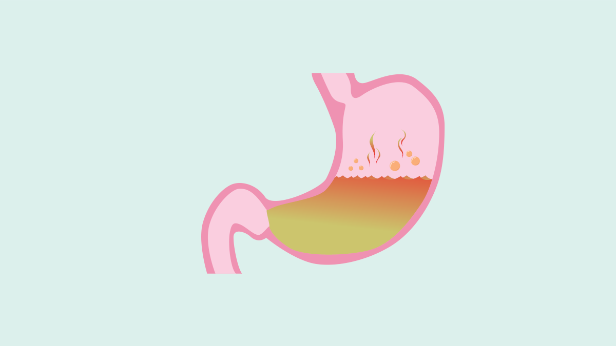 gerd-stomach-naturopathy treatment