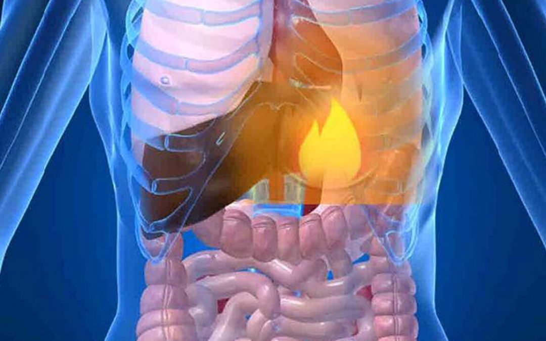 Chronic Acid Reflux and the Decline and Fall of the Modern Stomach: Part 2